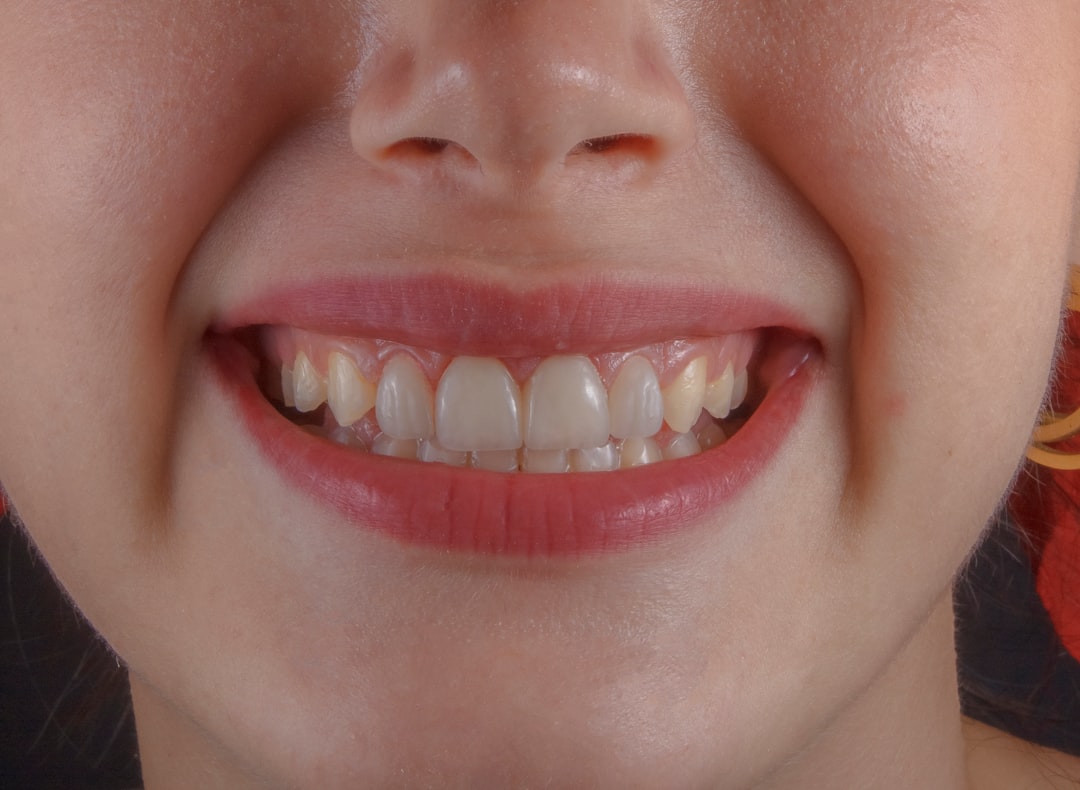 Dental Insurance Vs Dental Plan